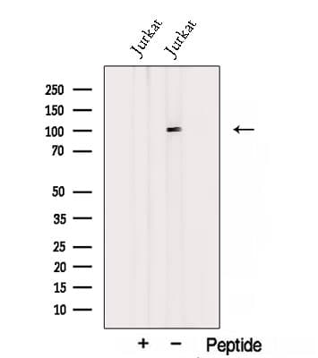 Polyclonal Rabbit anti-Human STIM2 Antibody (WB)
