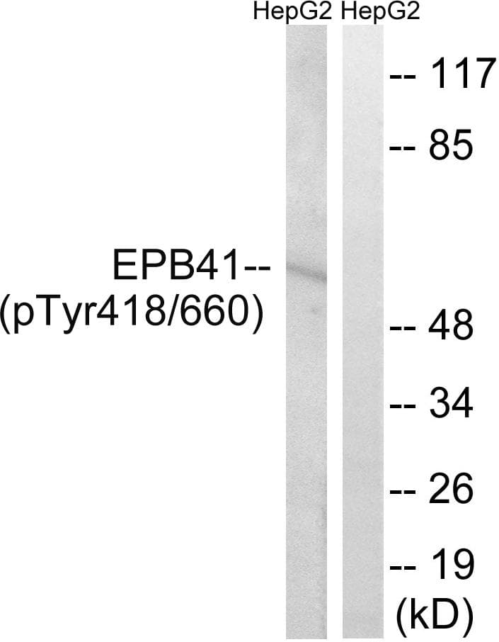 Band 4.1 / EPB41 Antibody (phospho-Tyr660/418)