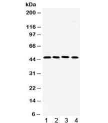 FOSL2 / FRA-2 Antibody