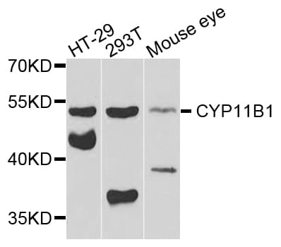 CYP11B1 Antibody
