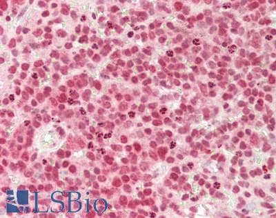Monoclonal Mouse anti-Human DNASE1 / DNase I Antibody (aa19-259, IHC, WB)
