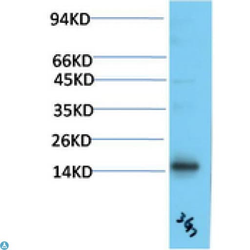 TTR / Transthyretin Antibody