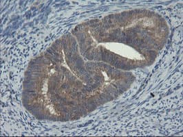 COMMD1 Antibody (clone OTI3B3)