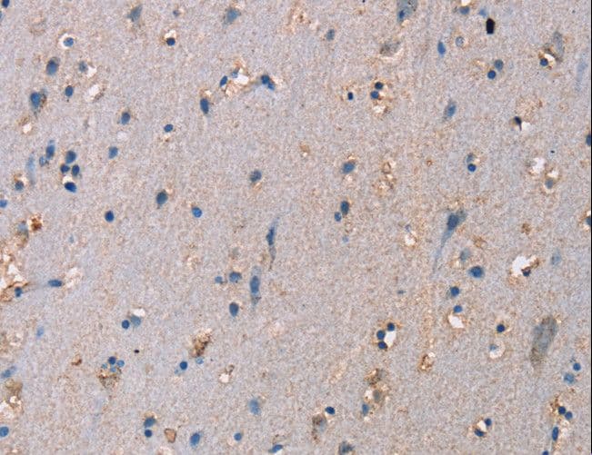 ADAM29 Antibody