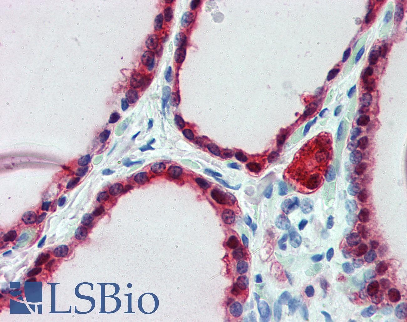IHC-plus™ FZD2 / Frizzled 2 Antibody (aa267-279)