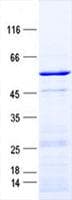 Human VDAC3 Protein (Recombinant GST, N-terminus + His, C-terminus)
