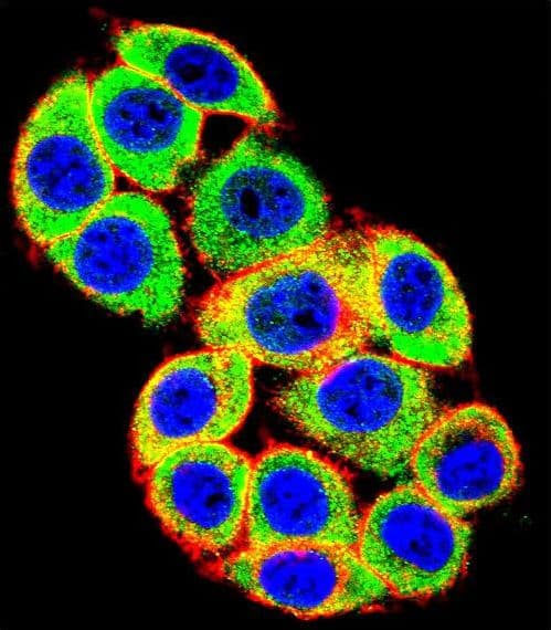 IHC-plus™ PRKCA / PKC-Alpha Antibody (aa75-103)