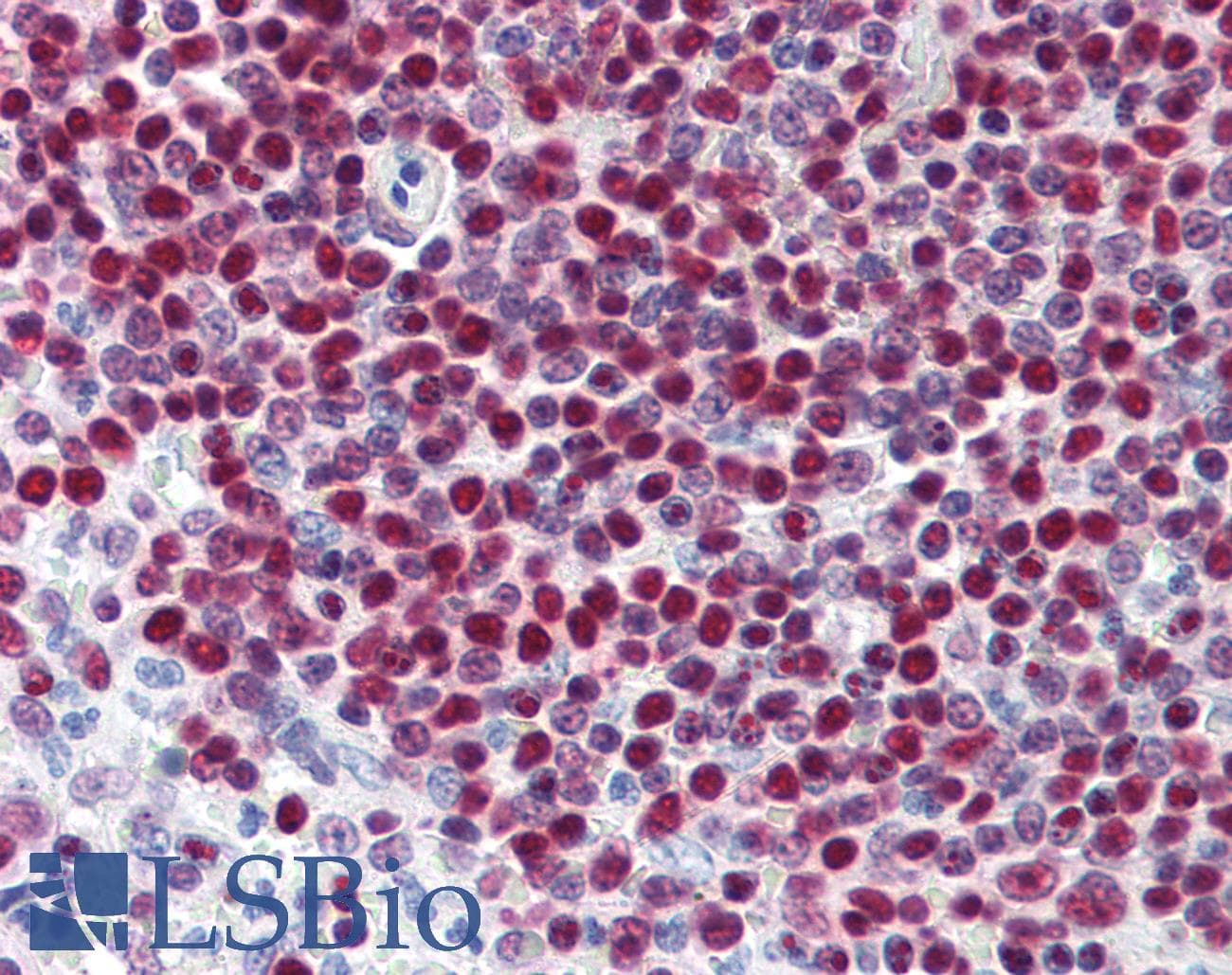 IHC-plus™ Monoclonal Mouse anti-Human PARP1 Antibody (clone A6.4.12, IHC, IF, WB)