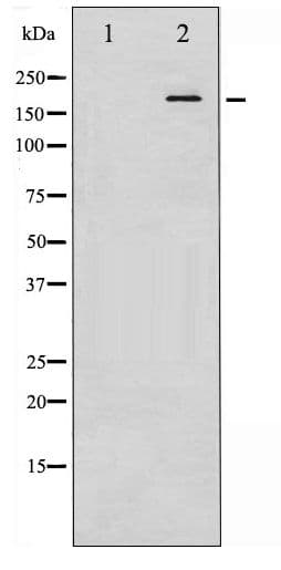 IRS1 Antibody (phospho-Ser307)
