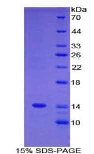 Mouse C4BPA / C4BP Alpha Protein (Recombinant His)