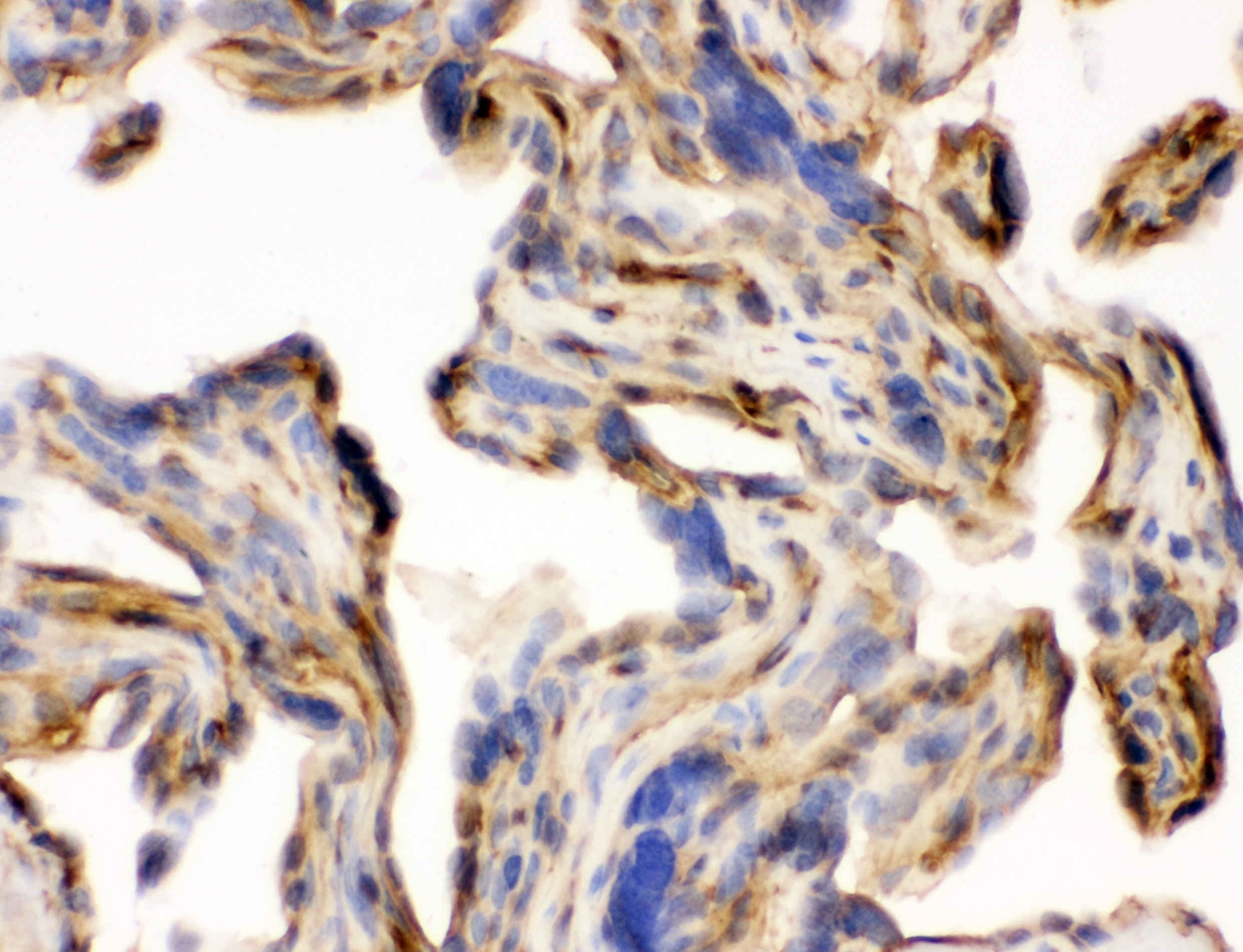 Polyclonal Rabbit anti-Human LAMC1 / Laminin Gamma 1 Antibody (IHC, WB)