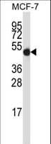 Polyclonal Rabbit anti-Human GDI2 Antibody (aa135-164, IHC, WB)