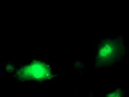 PDXK / PNK Antibody (clone OTI5H5)