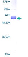 Human CITED1 Protein (Recombinant GST)