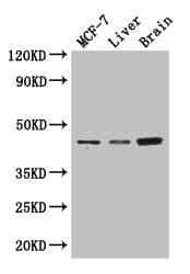 KCNJ11 / Kir6.2 Antibody