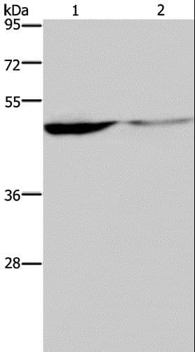 KCNK9 / TASK3 Antibody