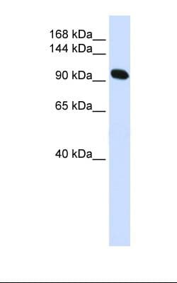 ACTN2 Antibody (N-Terminus)
