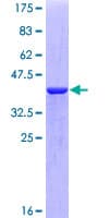 Human S100A7 / Psoriasin Protein (Recombinant GST)