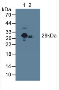 CRP / C-Reactive Protein Antibody (aa17-224, PE)
