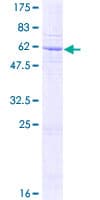 Human SFXN3 / Sideroflexin 3 Protein (Recombinant GST)
