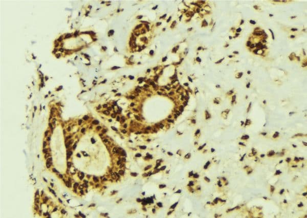 ZNF596 Antibody