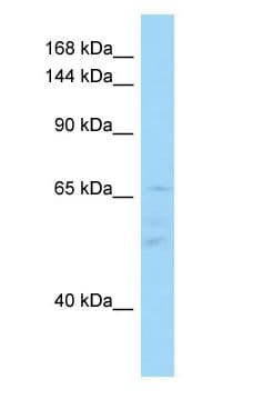 Polyclonal Rabbit anti-Human IL16 Antibody (C-Terminus, WB)