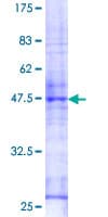 Human RAB26 Protein (Recombinant GST)