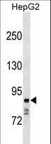 NAALADL / NAALADL1 Antibody (aa511-539)