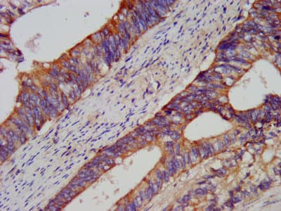 Polyclonal Rabbit anti-Human USP37 Antibody (IHC)