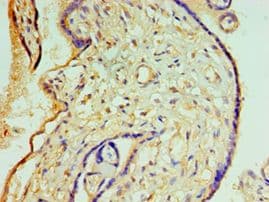 Polyclonal Rabbit anti-Human CREB3L2 / BBF2H7 Antibody (aa1-247, IHC, WB)