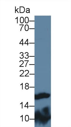 FABP9 / Lipid-Binding Protein Antibody (aa1-130)