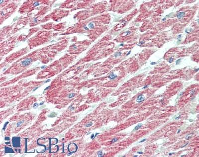 IHC-plus™ ACAA2 Antibody (clone 1C10)