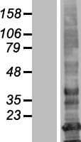 LHFPL3 Protein (Over-Expression Lysate Myc-DDK (Flag))