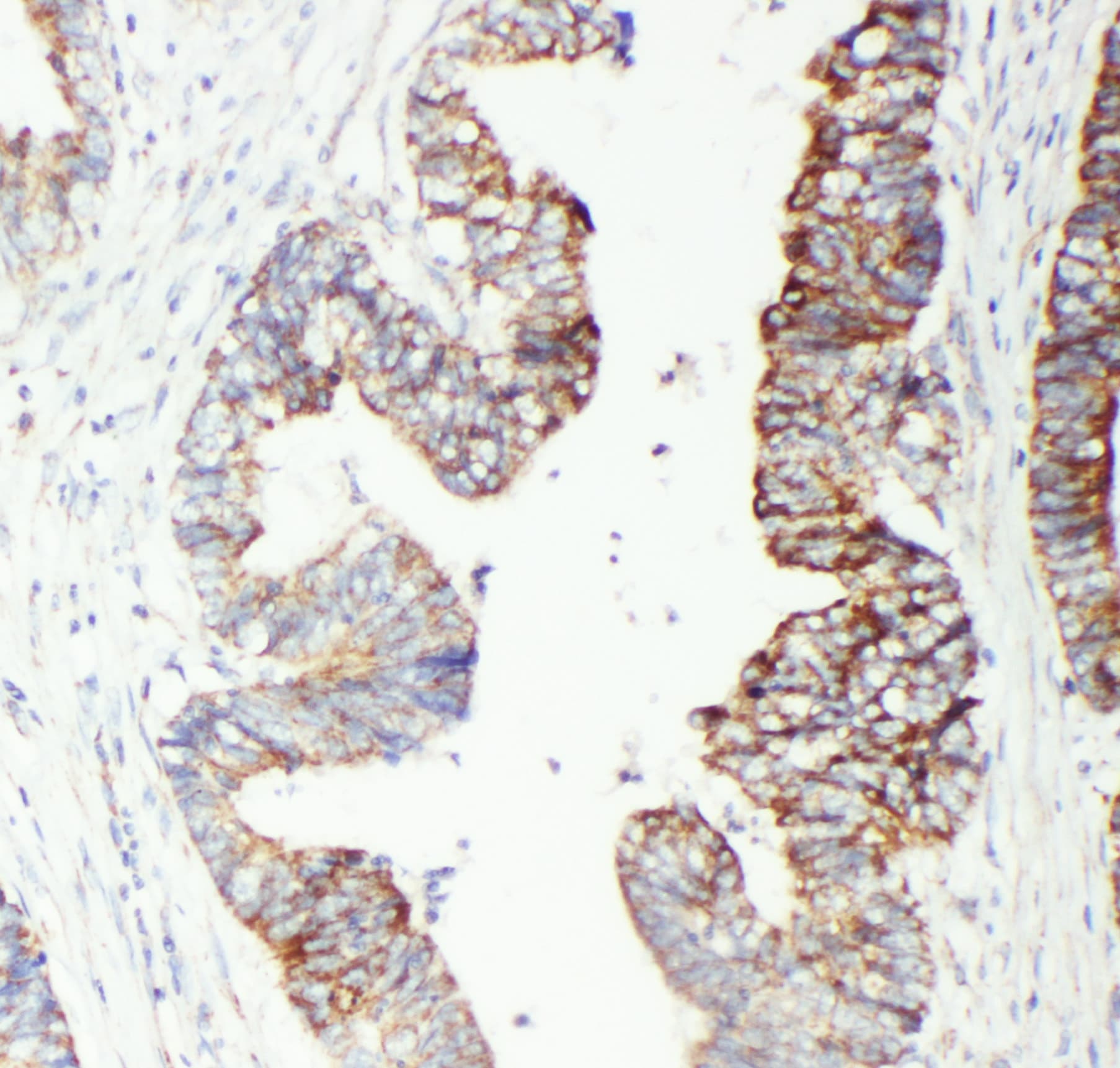 GSTP1 / GST Pi Antibody (aa12-32)