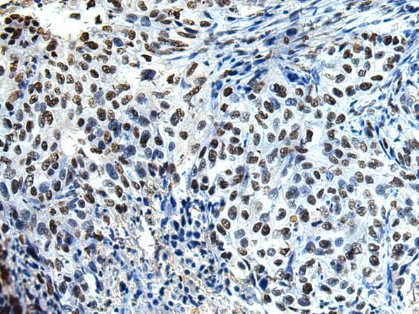 DDX39 Antibody