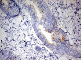 Monoclonal Mouse anti-Human DAP3 Antibody (clone OTI1A12, aa161-398, IHC, WB)