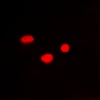 Polyclonal Rabbit anti-Human PSMB10 Antibody (IHC, IF, WB)