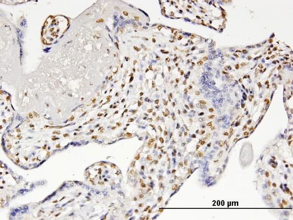 CBFA1 / RUNX2 Antibody (clone 6E1)