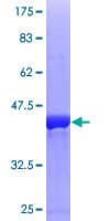 Human STMN1 / Stathmin / LAG Protein (Recombinant GST)