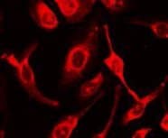 IHC-plus™ CD95 / FAS Antibody (N-Terminus)