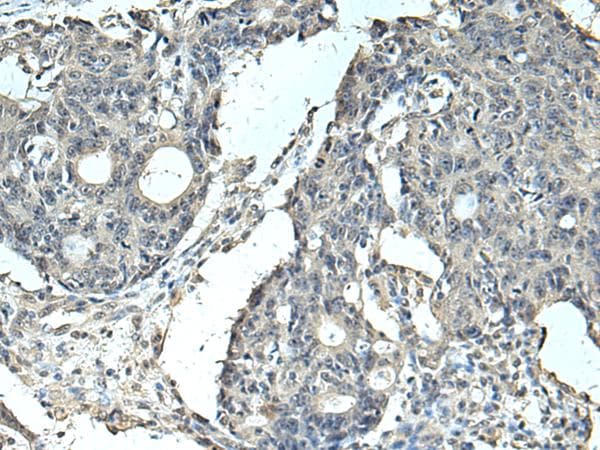 Polyclonal Rabbit anti-Human SLC35F6 Antibody (IHC)