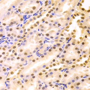 HDGF Antibody