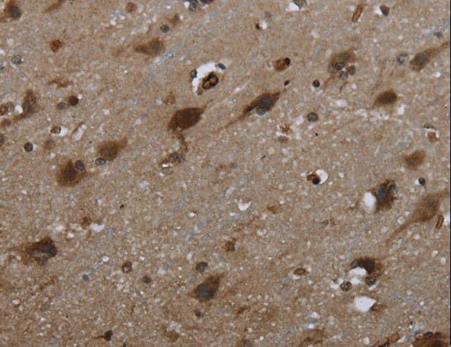 GLIPR1 / GLIPR Antibody