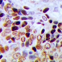NCBP2 / CBP20 Antibody (N-Terminus)