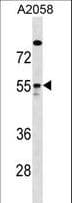 ARHGAP1 / CDC42GAP Antibody (aa126-154)