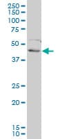 Monoclonal Mouse anti-Human FOXF2 Antibody (clone 2D7, WB)
