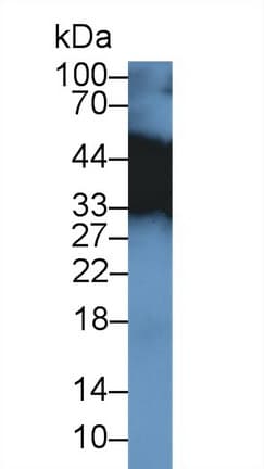 TPM3 Antibody (aa6-248, Cy3)