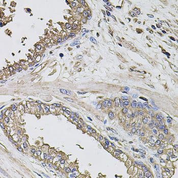 Polyclonal Rabbit anti-Human GRN / Granulin Antibody (IHC, WB)