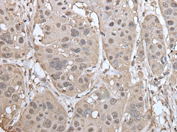UBASH3A / CLIP4 Antibody