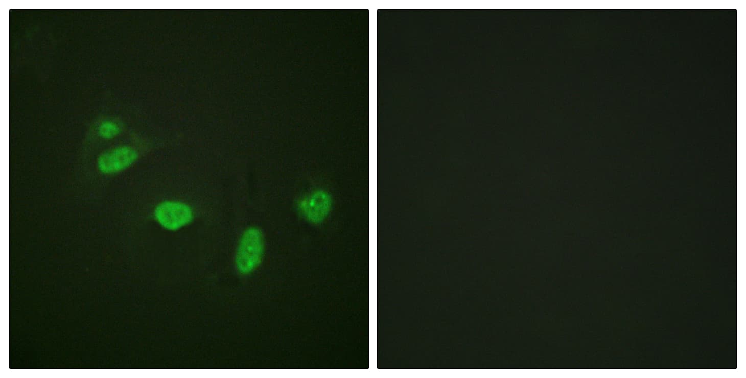ETS1 / ETS-1 Antibody (phospho-Thr38)